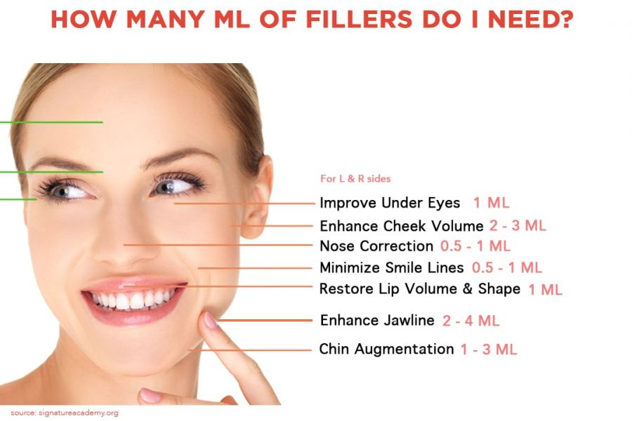 Dibawah jawaban _how many ml of filler do i need_