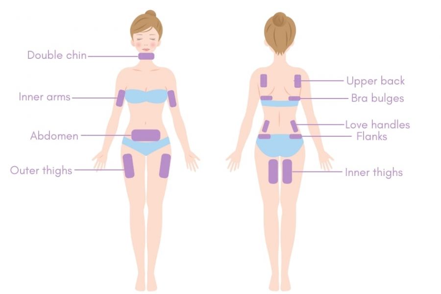 Fat Freezing dibawah judul Treatment Areas